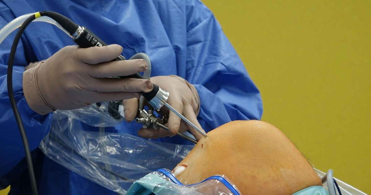 BEAR Implant for ACL Tears: Benefits, Evidence & Outcomes