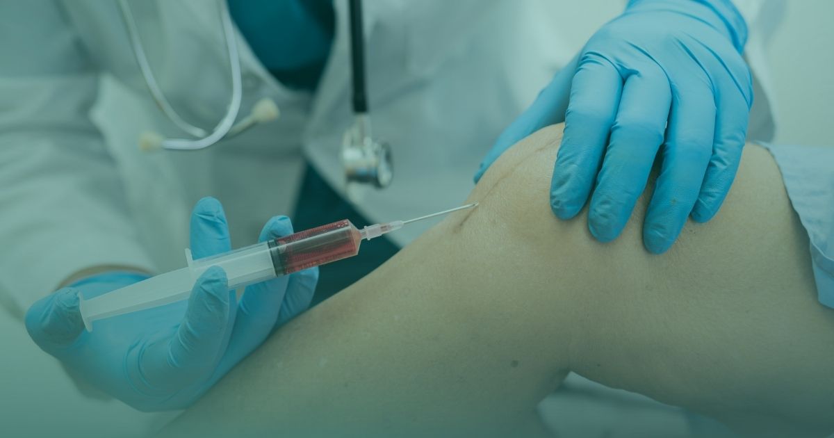 Cartilage Restoration in Orthopedics: Can We Delay the Progression of Arthritis?