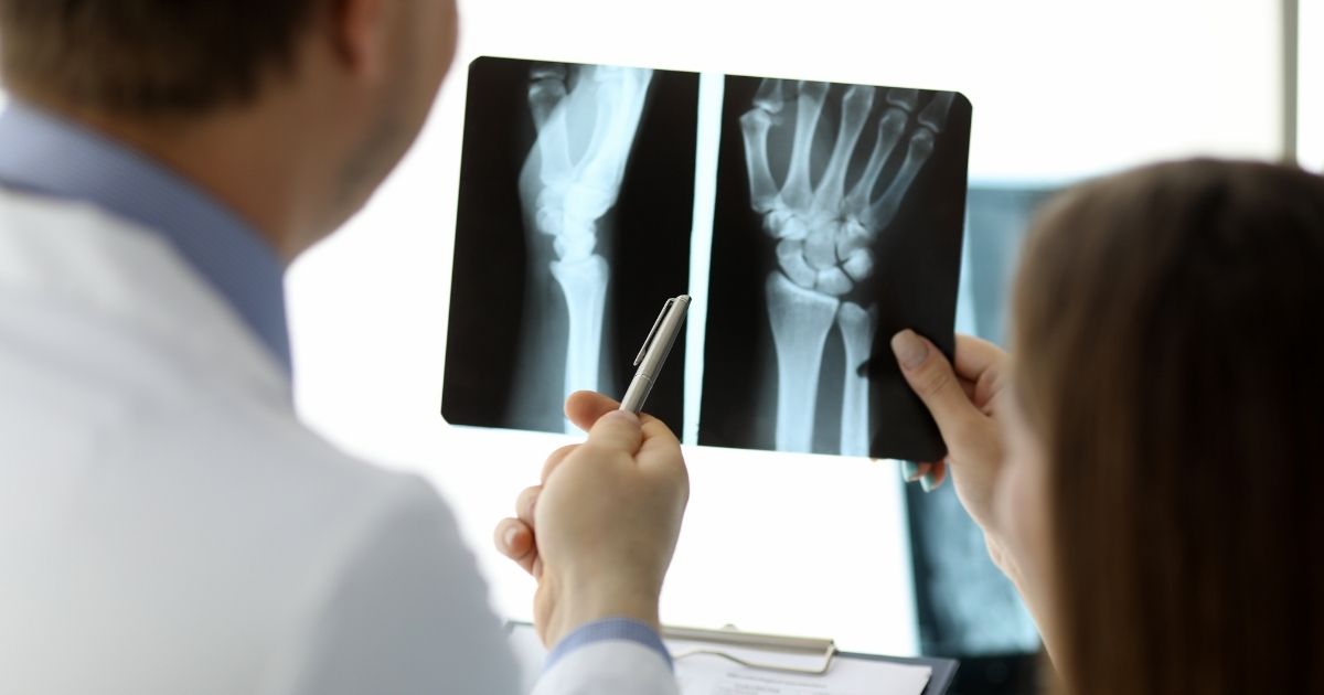Why Long-Term Data Collection Matters in Orthopedic Research